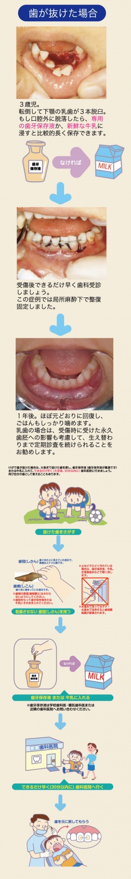 わんぱく大作戦 Tssテレビ新広島